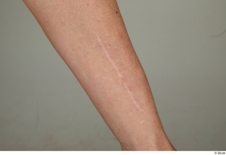 Steve Q forearm scar skin 0001.jpg